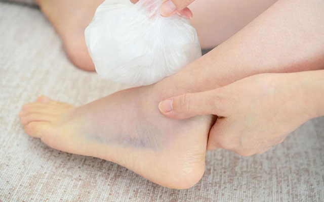 Bong gân là một trong những nguyên nhân chính dẫn đến đau mắt cá chân
