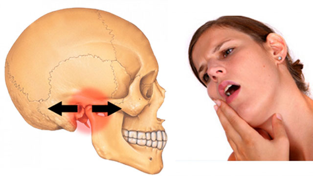 Có nhiều triệu chứng khác nhau khi bị rối loạn khớp thái dương hàm