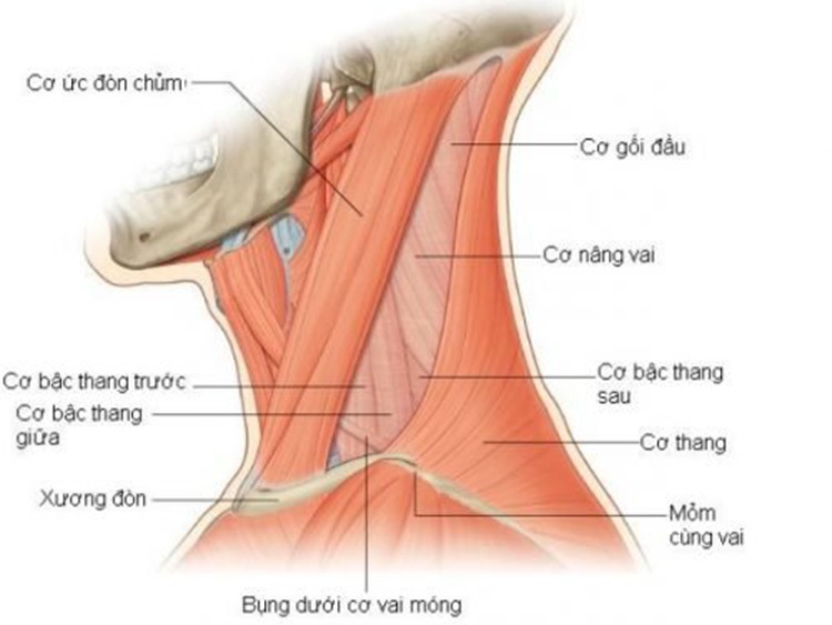 Căng cơ dẫn đến đau cổ vai gáy bên trái